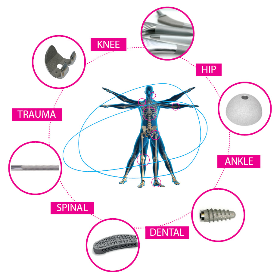 Our investment in research and development had led to improved medical implant design and production R&D is at the heart of the services and products that the biomedical division of the Unitedcoatings Group provides to its original equipment manufacturer customers.